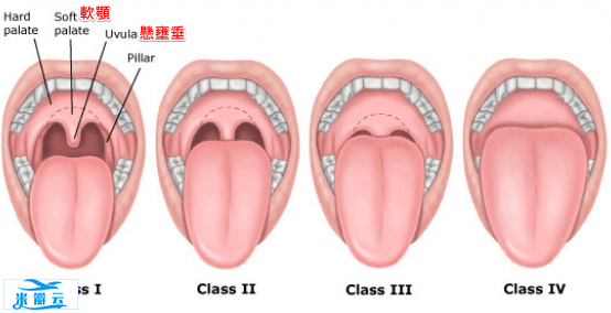 3种改善打鼾(呼)的训练