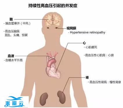 15张高血压医学美图，一文搞定高血压！