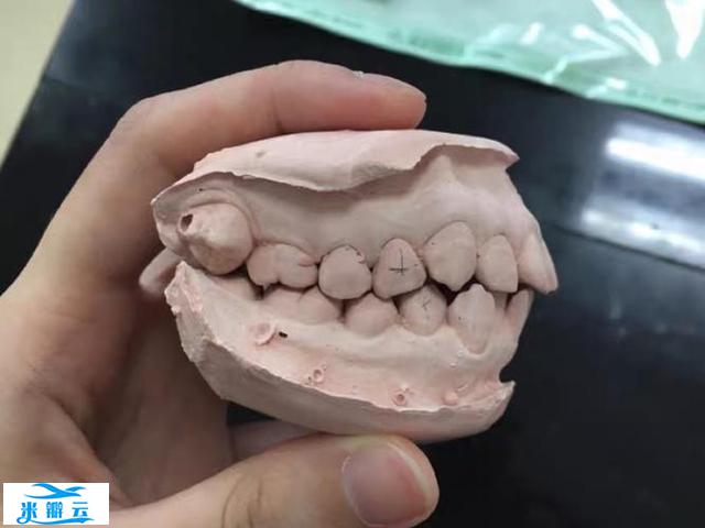 正畸过山车效应和钟摆效应是什么?出现这些效应该如何补救?